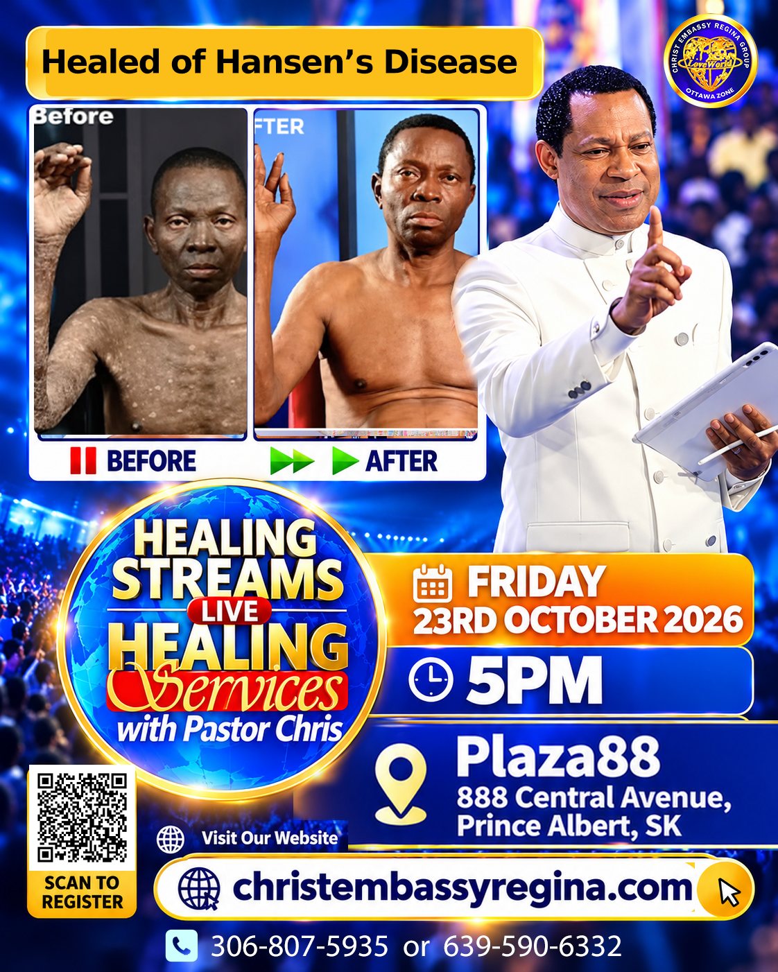 Healed of Hansen's disease